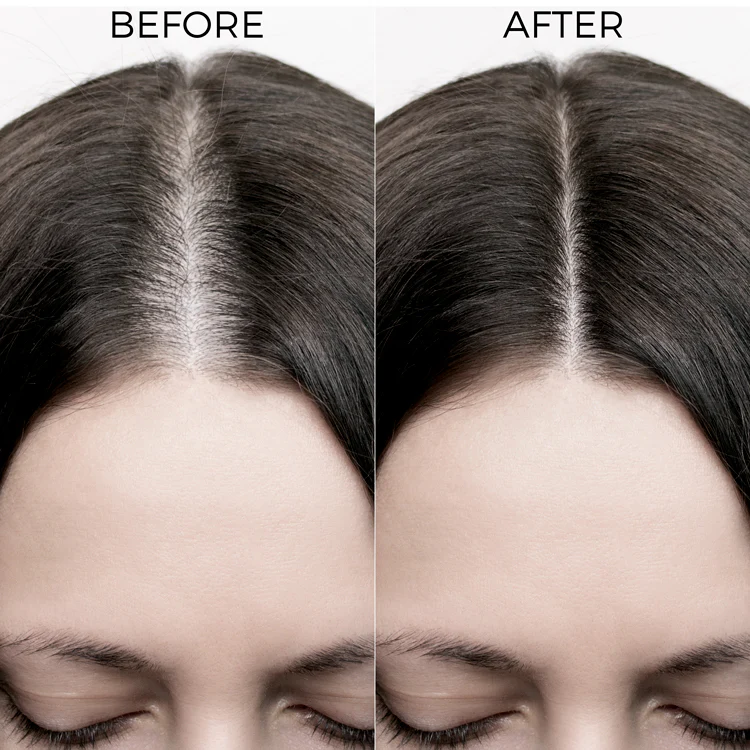 Caffeine & Redensyl Scalp Serum For Hair Growth - Image 4
