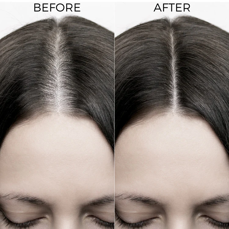Mahabhringraj Oil 100 ml - Image 6
